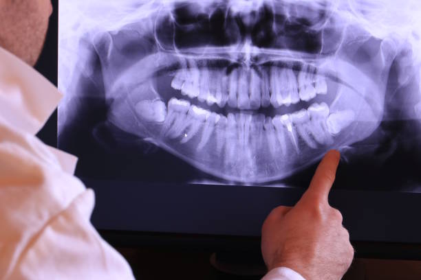Best Weekend Emergency Dentist in Suquamish, WA