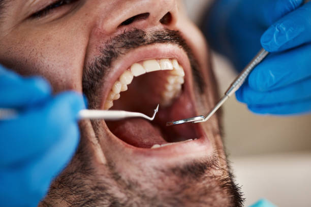 Best Weekend Emergency Dentist in Suquamish, WA